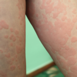 generic amoxil online