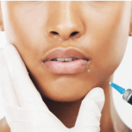 Lip Fillers at The Medispa: Enhance, Define, and Embrace Your Natural Smile