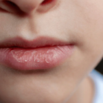 black spots on lower lip
