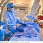 Brain Aneurysm Center