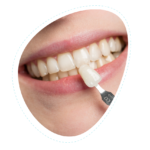 Cosmetic Dentistry in San Antonio Tx