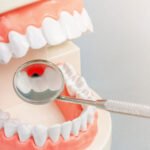 dental implants in Converse TX