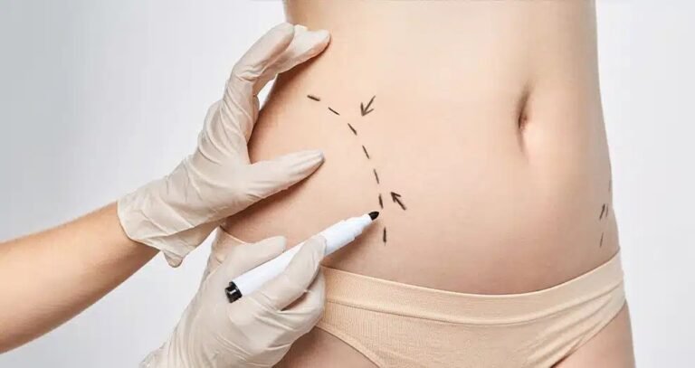 Recovery Tips After Body Contouring in Dubai