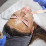 تكلفة جلسات التقشير الكيميائي في دبي