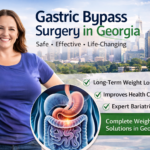 Gastric Bypass Surgery