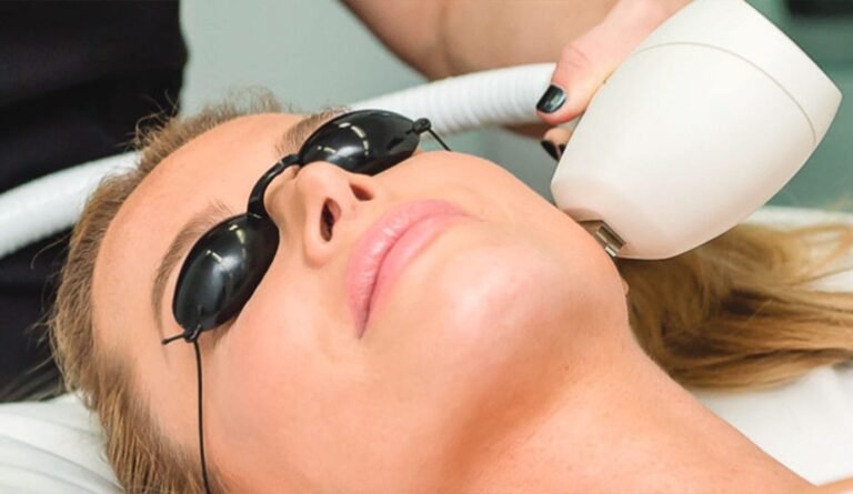 IPL Photofacial