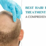 Best Hair Fall Treatment