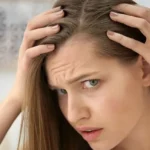 Female pattern baldness treatment in Lahore Karachi Peshawar Islamabad Faisalabad