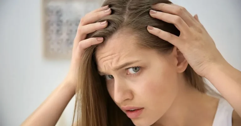 Female pattern baldness treatment in Lahore Karachi Peshawar Islamabad Faisalabad