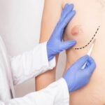 Transform Your Chest with Enfield clinic Gynecomastia Specialists