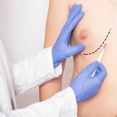 Transform Your Chest with Enfield clinic Gynecomastia Specialists Transform Your Chest with Enfield clinic Gynecomastia Specialists