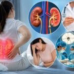 Kidney Stone Surgery Recovery Timeline and Important Health Signs