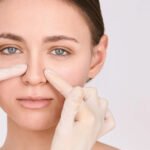 Rhinoplasty in Dubai