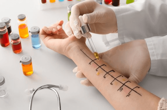 Allergist Doctor Dubai for Long-Term Allergy Management