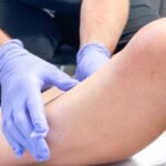 Vein Treatment Clinic Arcadia