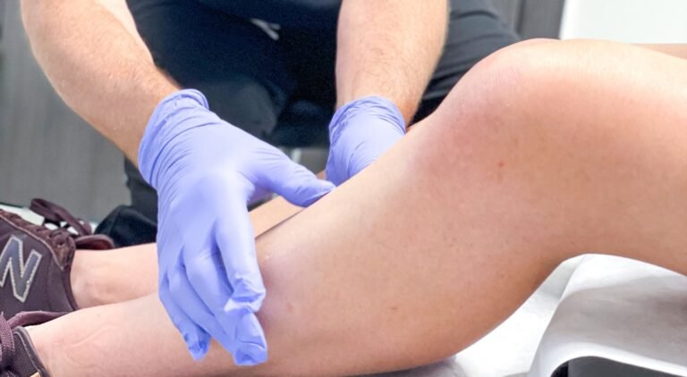 Vein Treatment Clinic Arcadia