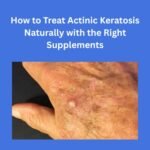 How to Treat Actinic Keratosis Naturally