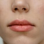 Lip Peptide